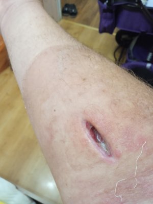 IMG_20230826_182236.jpg IMG_20230826_182236.jpg